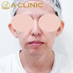 A CLINIC（エークリニック） 新宿院 片桐 大佑医師の症例