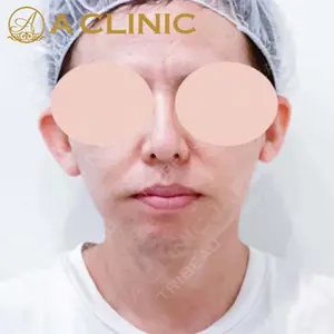 A CLINIC（エークリニック） 新宿院 片桐 大佑医師の症例