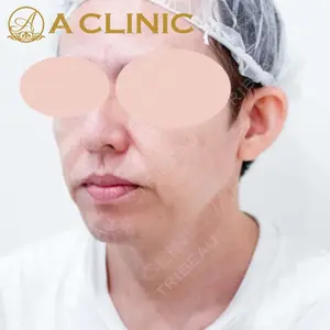 A CLINIC（エークリニック） 新宿院 片桐 大佑医師の症例