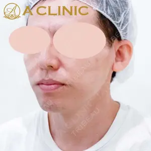 A CLINIC（エークリニック） 新宿院 片桐 大佑医師の症例