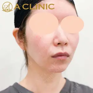 A CLINIC（エークリニック） 新宿院 片桐 大佑医師の症例