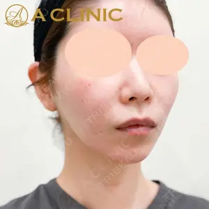 A CLINIC（エークリニック） 新宿院 片桐 大佑医師の症例