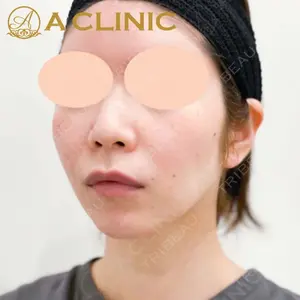 A CLINIC（エークリニック） 新宿院 片桐 大佑医師の症例