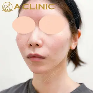 A CLINIC（エークリニック） 新宿院 片桐 大佑医師の症例