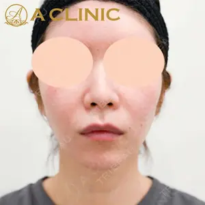 A CLINIC（エークリニック） 新宿院 片桐 大佑医師の症例