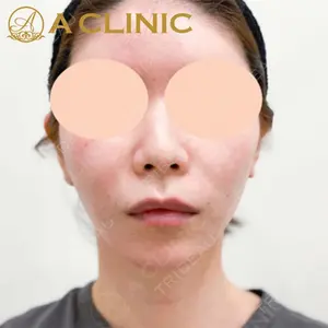 A CLINIC（エークリニック） 新宿院 片桐 大佑医師の症例