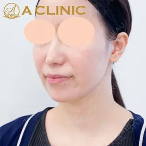 A CLINIC（エークリニック） 新宿院 片桐 大佑医師の症例