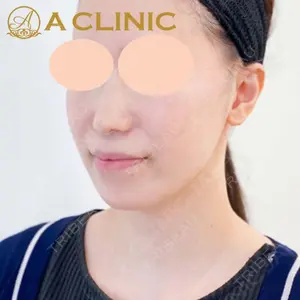 A CLINIC（エークリニック） 新宿院 片桐 大佑医師の症例