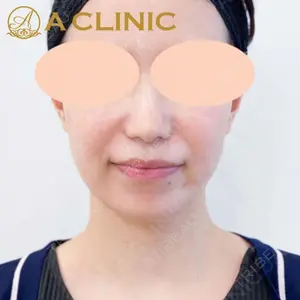 A CLINIC（エークリニック） 新宿院 片桐 大佑医師の症例