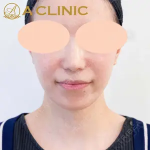 A CLINIC（エークリニック） 新宿院 片桐 大佑医師の症例