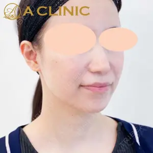 A CLINIC（エークリニック） 新宿院 片桐 大佑医師の症例