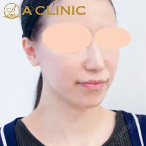 A CLINIC（エークリニック） 新宿院 片桐 大佑医師の症例