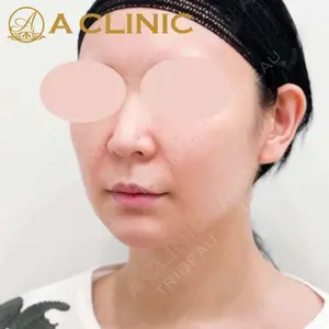 A CLINIC（エークリニック） 新宿院 片桐 大佑医師の症例