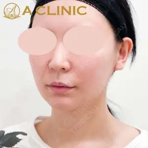 A CLINIC（エークリニック） 新宿院 片桐 大佑医師の症例