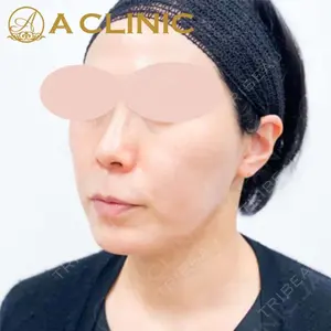 A CLINIC（エークリニック） 新宿院 片桐 大佑医師の症例