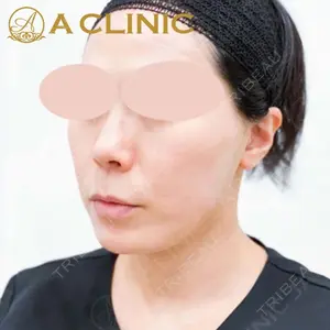 A CLINIC（エークリニック） 新宿院 片桐 大佑医師の症例