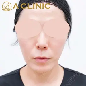 A CLINIC（エークリニック） 新宿院 片桐 大佑医師の症例