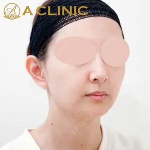 A CLINIC（エークリニック） 新宿院 片桐 大佑医師の症例