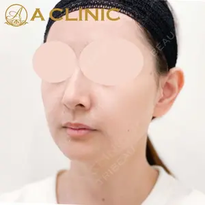 A CLINIC（エークリニック） 新宿院 片桐 大佑医師の症例