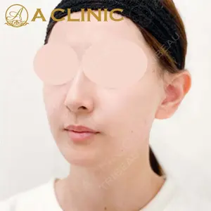 A CLINIC（エークリニック） 新宿院 片桐 大佑医師の症例