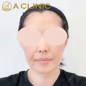 A CLINIC（エークリニック） 新宿院 片桐 大佑医師の症例