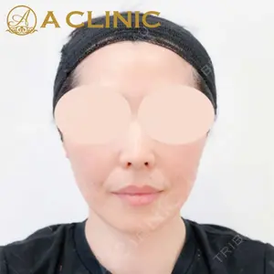 A CLINIC（エークリニック） 新宿院 片桐 大佑医師の症例