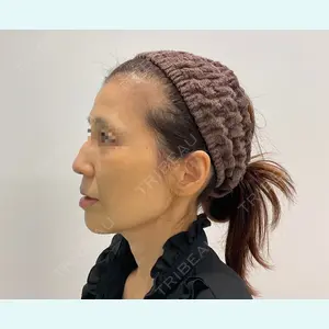 ユウコ形成外科クリニック 植田　有子医師の症例