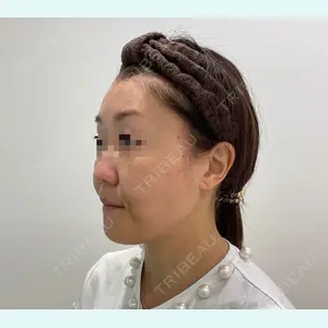 ユウコ形成外科クリニック 植田　有子医師の症例