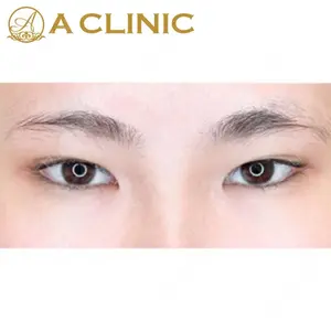 A CLINIC（エークリニック） 新宿院 片桐 大佑医師の症例