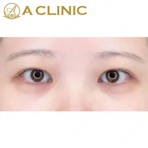 A CLINIC（エークリニック） 新宿院 片桐 大佑医師の症例