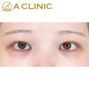 A CLINIC（エークリニック） 新宿院 片桐 大佑医師の症例