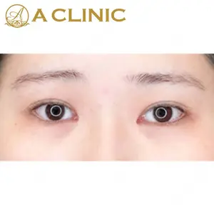 A CLINIC（エークリニック） 新宿院 片桐 大佑医師の症例