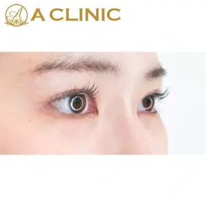 A CLINIC（エークリニック） 新宿院 片桐 大佑医師の症例