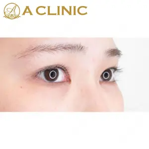 A CLINIC（エークリニック） 新宿院 片桐 大佑医師の症例