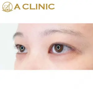 A CLINIC（エークリニック） 新宿院 片桐 大佑医師の症例