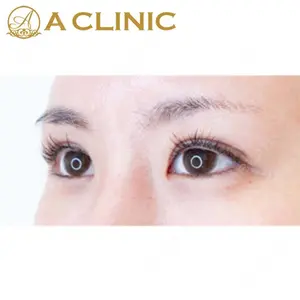 A CLINIC（エークリニック） 新宿院 片桐 大佑医師の症例