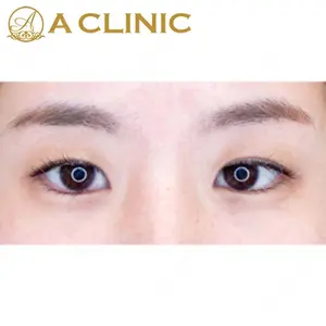 A CLINIC（エークリニック） 新宿院 片桐 大佑医師の症例