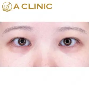 A CLINIC（エークリニック） 新宿院 片桐 大佑医師の症例