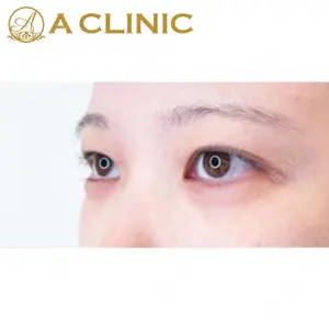 A CLINIC（エークリニック） 新宿院 片桐 大佑医師の症例