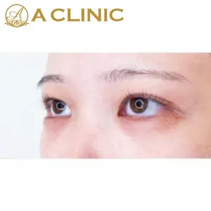 A CLINIC（エークリニック） 新宿院 片桐 大佑医師の症例