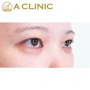 A CLINIC（エークリニック） 新宿院 片桐 大佑医師の症例