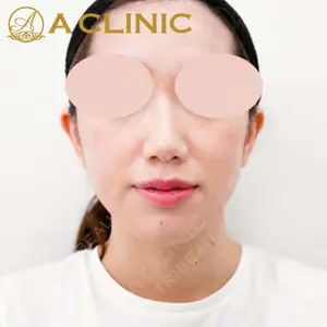 A CLINIC（エークリニック） 新宿院 片桐 大佑医師の症例