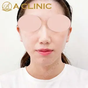 A CLINIC（エークリニック） 新宿院 片桐 大佑医師の症例