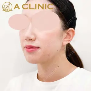 A CLINIC（エークリニック） 新宿院 片桐 大佑医師の症例