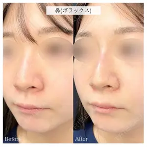 ルラ美容クリニック 千葉院 下川 洋輝医師の症例