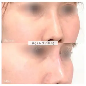 ルラ美容クリニック 千葉院 下川 洋輝医師の症例