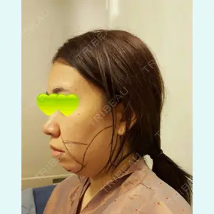 TL美容クリニック リフティング・皮膚管理センター ムン・ヘヨン院長医師の症例