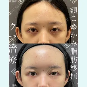 EMMO FACE CLINIC 大宮院 廣松 直樹医師の症例