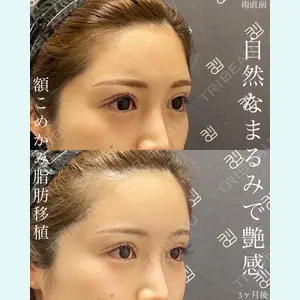 EMMO FACE CLINIC 大宮院 廣松 直樹医師の症例