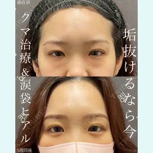 EMMO FACE CLINIC 大宮院 廣松 直樹医師の症例